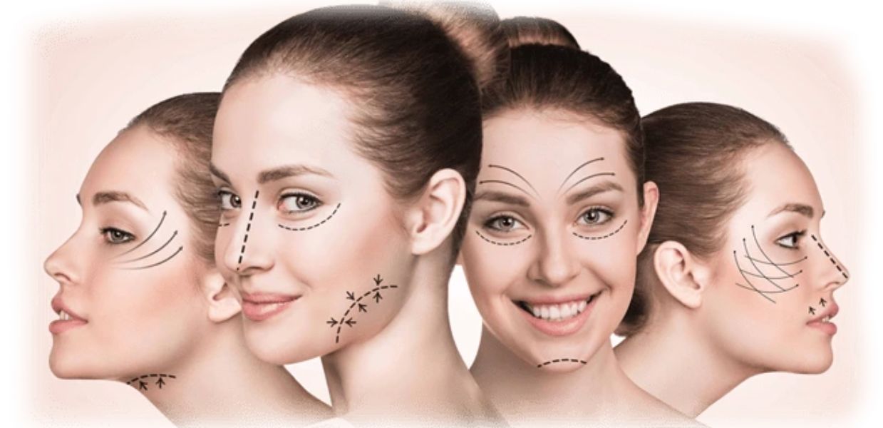 Face Lift & Neck Lift Cosmetic Surgery in India